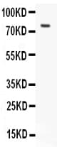 LHCGR / LHR / LH Receptor Antibody (aa127-143)