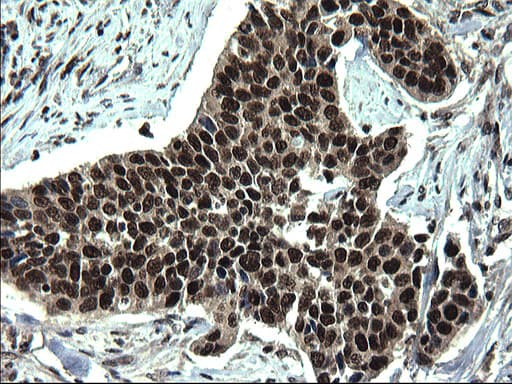 RPRD1B Antibody (clone OTI1C9)