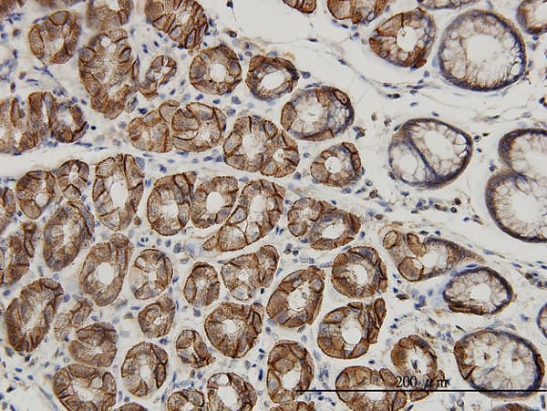 IHC-plus™ Monoclonal Mouse anti-Human AHCYL1 / DCAL Antibody (clone 5D6, IHC, WB)