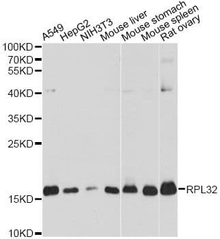 RPL32 / Ribosomal Protein L32 Antibody