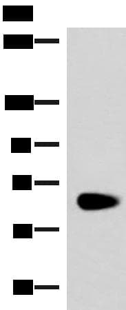 NOTCH4 Antibody