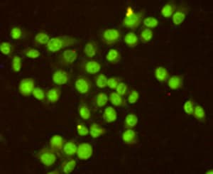 RPA2 / RFA2 / RPA34 Antibody