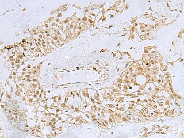 FOXQ1 Antibody