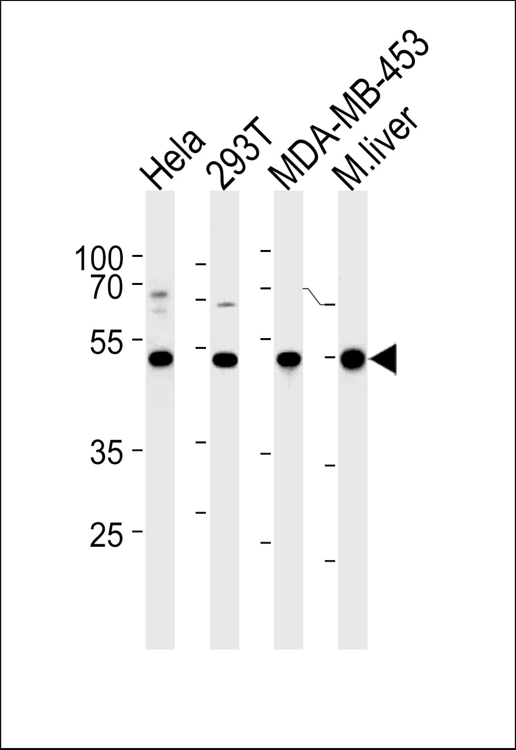GSS / Glutathione Synthetase Antibody (aa372-400)