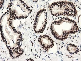 Monoclonal Mouse anti-Human SULT1A1 / Sulfotransferase 1A1 Antibody (clone OTI9B7, IHC, IF, WB)