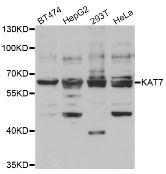 Polyclonal Rabbit anti-Human MYST2 / HBO1 Antibody (aa1-320, IHC, WB)