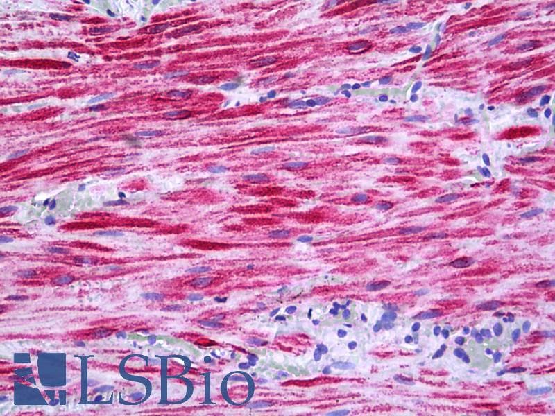 IHC-plus™ PRKD2 / PKD2 Antibody (aa829-878)