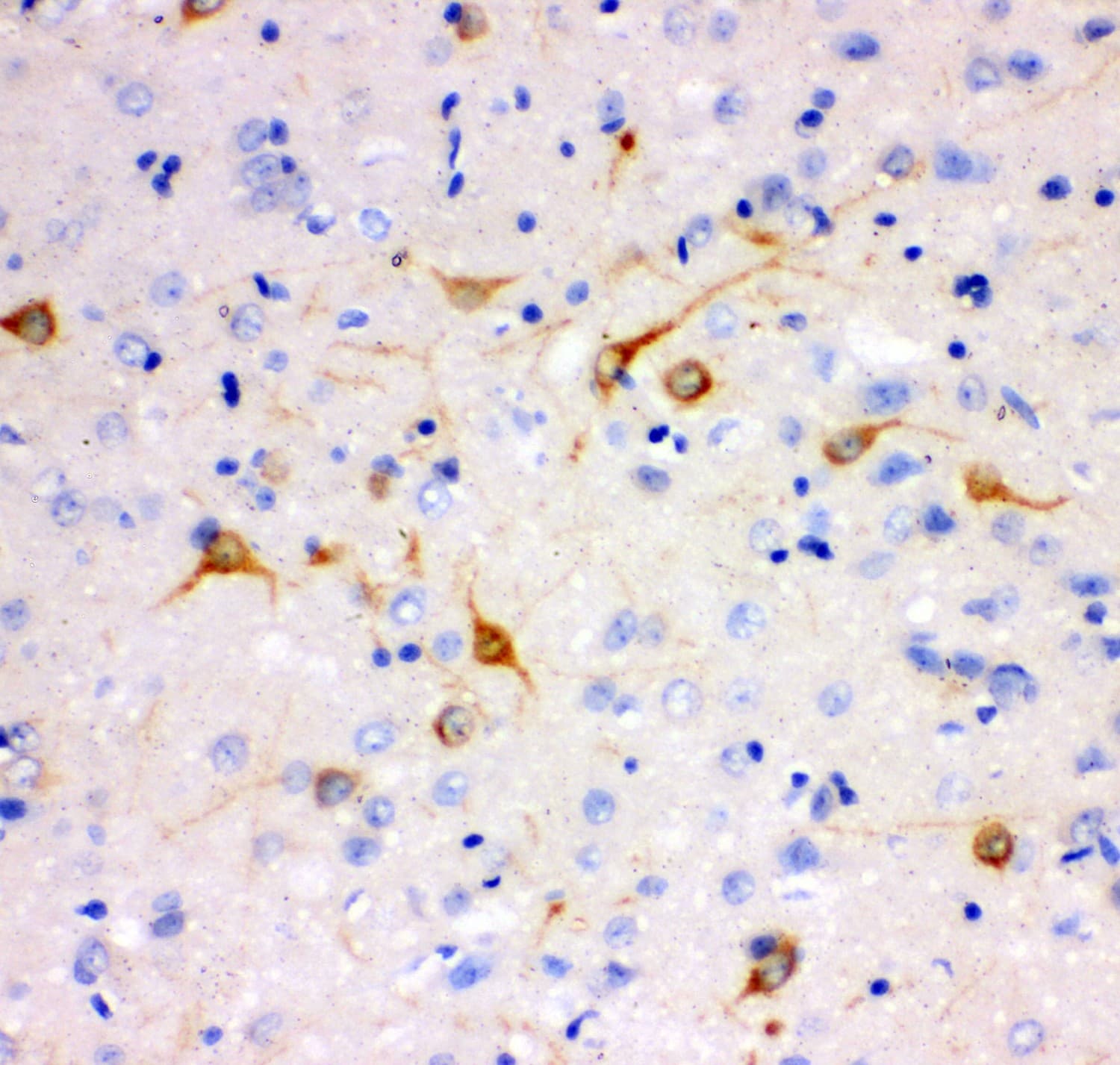 Polyclonal Rabbit anti-Human ITPR1 / IP3 Receptor Type 1 Antibody (aa2411-2758, IHC, WB)