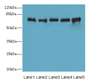 SPDL1 / CCDC99 Antibody
