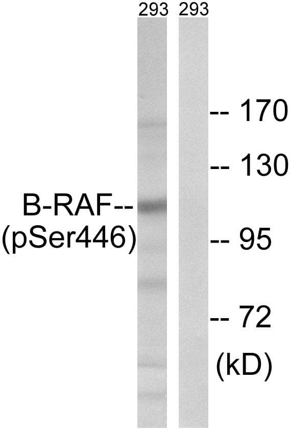 BRAF / B-Raf Antibody (p446)
