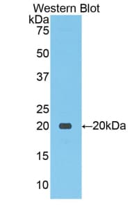SLC12A3 / TSC Antibody (aa867-1024, APC)