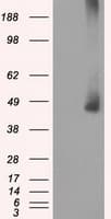 MAP2K1 / MKK1 / MEK1 Antibody (clone OTI1F5)