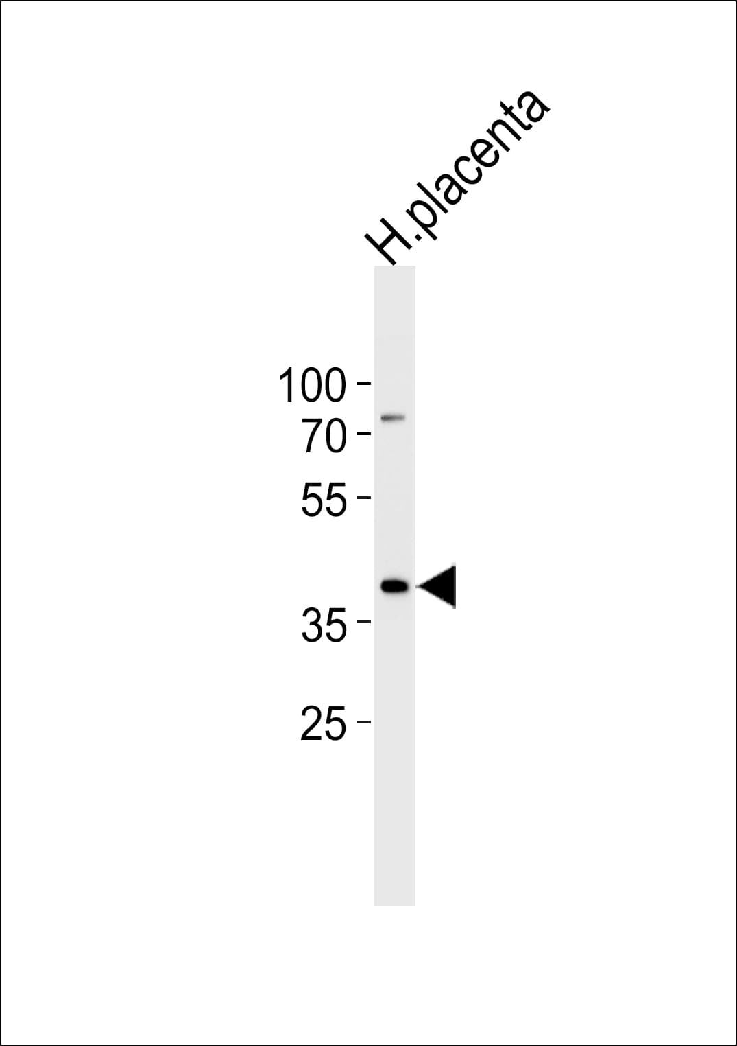 IDH3G Antibody (aa366-393)