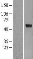 PEA3 / ETV4 Protein (Over-Expression Lysate Myc-DDK (Flag))