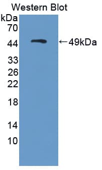MTA2 Antibody (aa1-394)