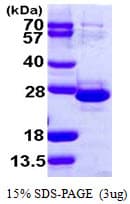 Human TCEAL1 Protein (Recombinant His)