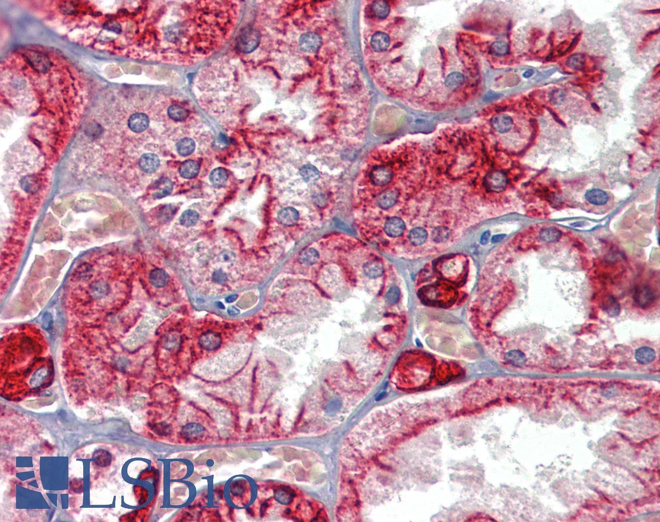 IHC-plus™ Monoclonal Mouse anti-Human KRT18 / CK18 / Cytokeratin 18 Antibody (clone 4D11E4, IHC, WB)