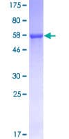Human AKR1D1 Protein (Recombinant GST)