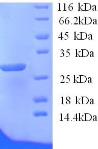 Human ATP4B Protein (Recombinant His)