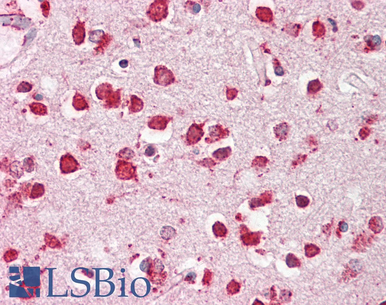 IHC-plus™ LIMPII / SCARB2 Antibody (aa96-110)