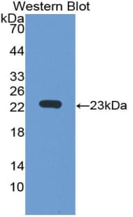 IGLL1 / CD179b Antibody (aa29-201)