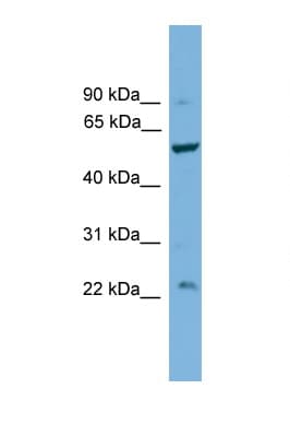 Polyclonal Rabbit anti-Human PPP5C Antibody (C-Terminus, WB)