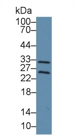 TIMP4 Antibody (aa42-224)