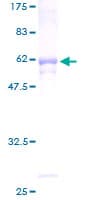 Human CYC1 / Cytochrome C-1 Protein (Recombinant GST)