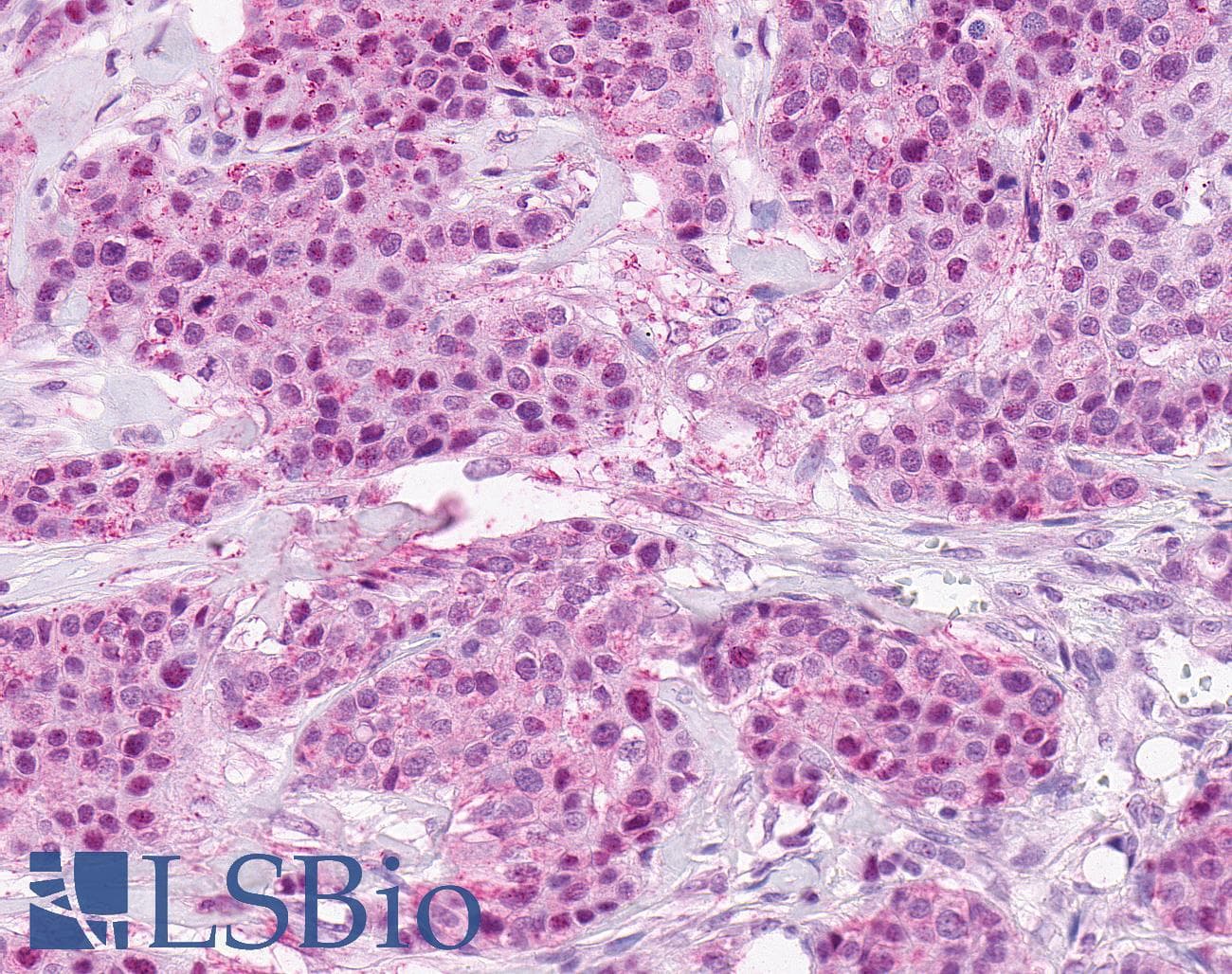 IHC-plus™ SSTR4 Antibody (N-Terminus)