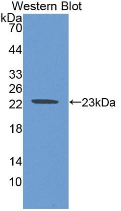 CLMP / ACAM Antibody (aa19-183, Biotin)