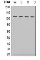 AR / Androgen Receptor Antibody (Internal)
