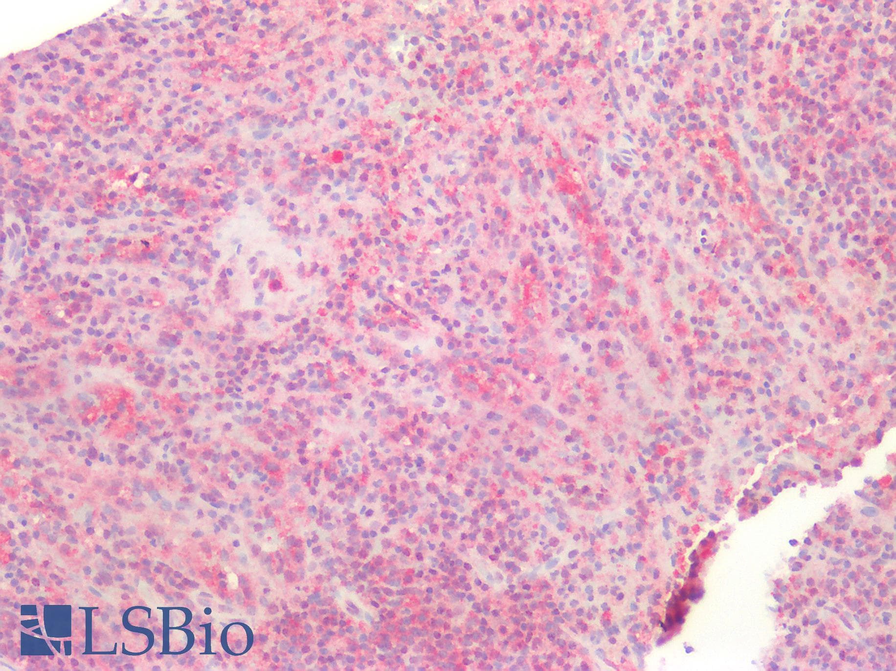 PathPlus™ CASP10 / Caspase 10 Antibody