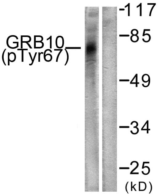 GRB10 Antibody (phospho-Tyr67)