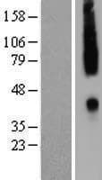 Human CCR2 Protein (Over-Expression Lysate Myc-DDK (Flag))