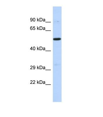 Polyclonal Rabbit anti-Human PRDM11 Antibody (aa356-405, WB)