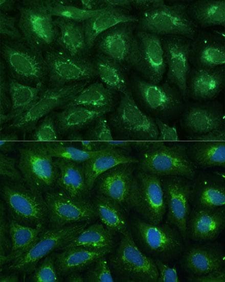 ABCD2 / ALDR Antibody