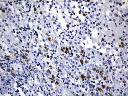 TS / Thymidylate Synthase Antibody (clone UMAB227, Carrier-free)