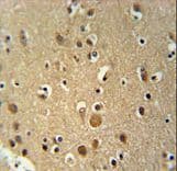 Polyclonal Rabbit anti-Human TNIP3 Antibody (aa74-102, IHC, WB)