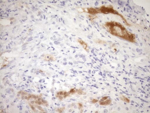 p16INK4a / CDKN2A Antibody (clone OTI1H3)
