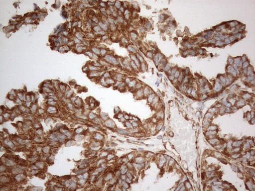 VAP33 / VAPA Antibody (aa2-227, clone OTI10E10)