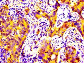 Polyclonal Rabbit anti-Human MATN2 / Matrilin 2 Antibody (IHC)