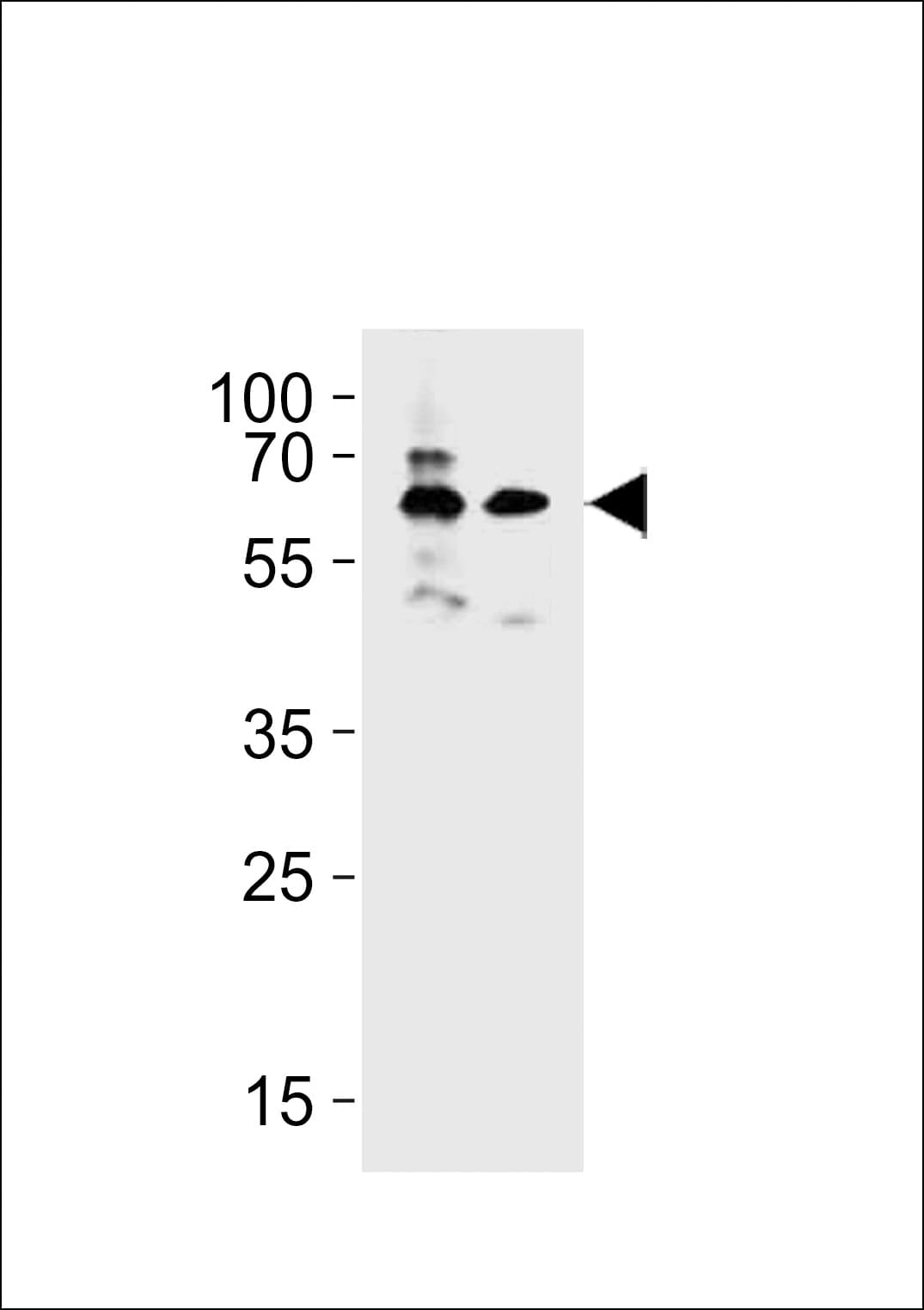 BTRCP / BETA-TRCP Antibody (aa127-156)