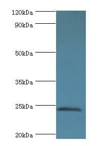 Polyclonal Rabbit anti-Human SOST / Sclerostin Antibody (aa24-213, IHC, WB)