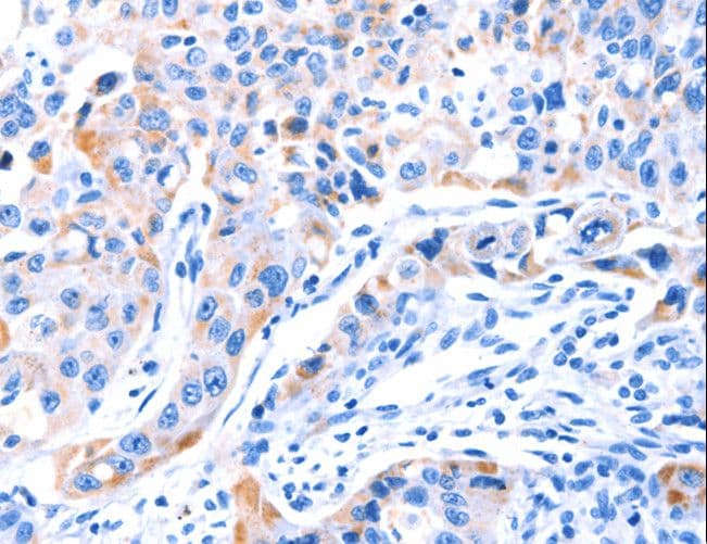C17orf71 Antibody