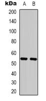 PathPlus™ KRT8 / CK8 / Cytokeratin 8 Antibody