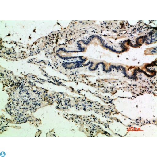 THBS4 / Thrombospondin 4 Antibody