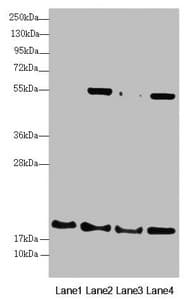 Polyclonal Rabbit anti-Human RMA1 / RNF5 Antibody (IHC, WB)