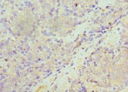 SULT1A1 / Sulfotransferase 1A1 Antibody (aa1-295)