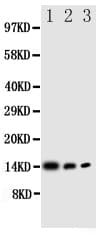 Polyclonal Rabbit anti-Human IL4 Antibody (aa72-88, IHC, WB)