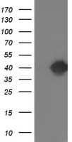 TOMM34 Antibody (clone OTI1B6)